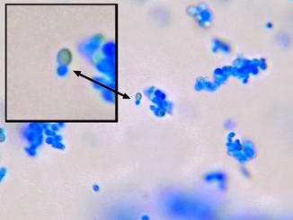 Malassezia furfur - грибок, проживающий в роговом слое кожи