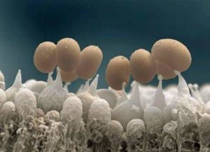 Грибок ногтя под микроскопом