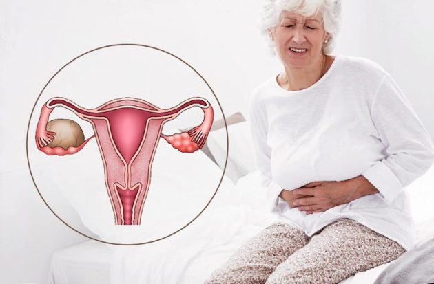 Оофорэктомия (удаление придатков) у женщин после 40, 50, 60 лет: последствия и состояние организма