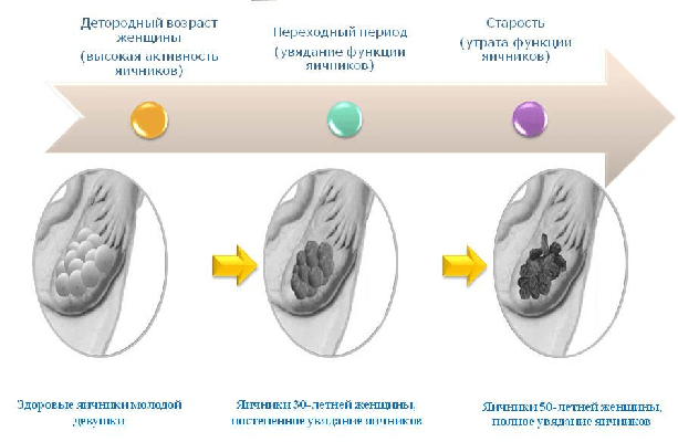 Клиновидная резекция яичников