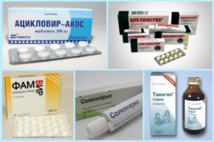 Препараты для лечения герпевируса