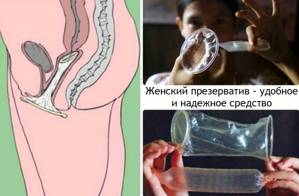 Презервативы для женщин