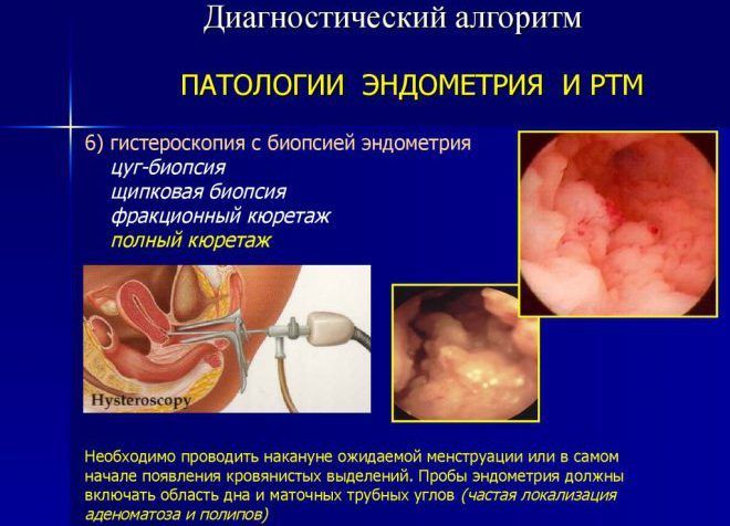 Патологические процесс эндометрия