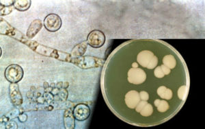 Грибок Candida albicans под микросскопом