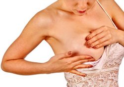 Лечение молочницы при грудном вскармливании