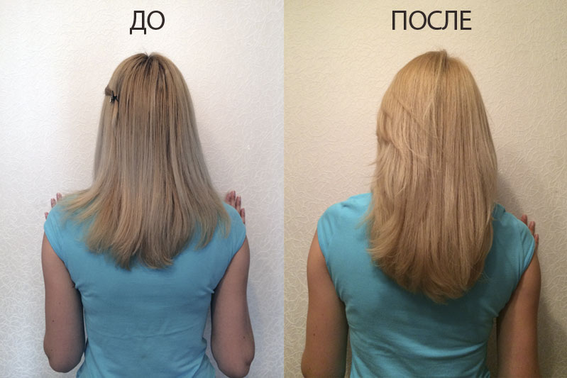 Маска против выпадения волос до и после