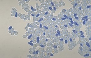 Клетки Malassezia