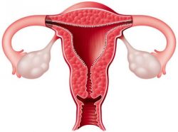 Что такое гипоплазия матки